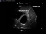 Transthoracic Echocardiography and Pericardiocentesis Ultrasound Training Model | BP-TTE1701-H | Blue Phantom | Sim & Skills