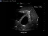 Transthoracic Echocardiography and Pericardiocentesis Ultrasound Training Model | BP-TTE1701-H | Blue Phantom | Sim & Skills