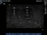 Ultrasound Phantom: Foreign Body VTA714 | Sim & Skills