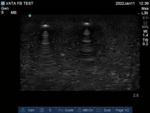 Ultrasound Phantom: Foreign Body VTA714 | Sim & Skills
