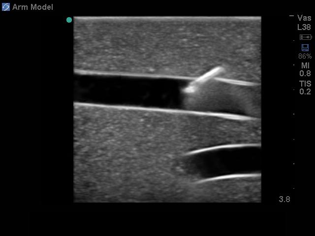Upper Arm Tissue Insert with Brachial and Basilic Vessels BPAI205 | Sim & Skills