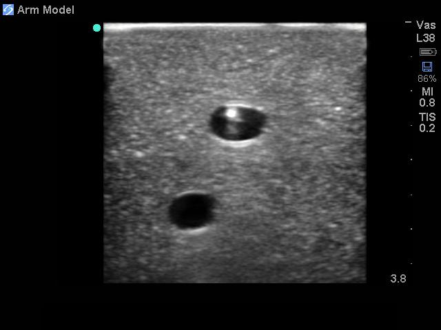 Upper Arm Tissue Insert with Brachial and Basilic Vessels BPAI205 | Sim & Skills