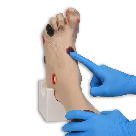 Wilma Wound Foot VTA0950 | Sim & Skills