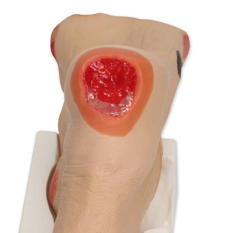 Wilma Wound Foot VTA0950 | Sim & Skills