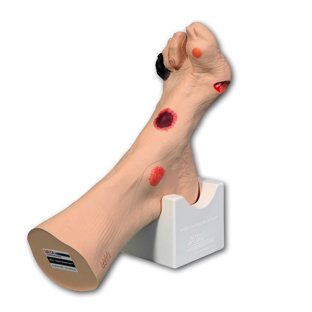 Wilma Wound Foot VTA0950 | Sim & Skills