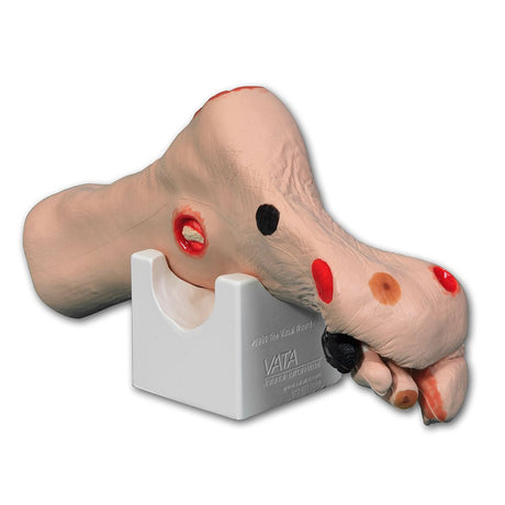 Wilma Wound Foot VTA0950 | Sim & Skills