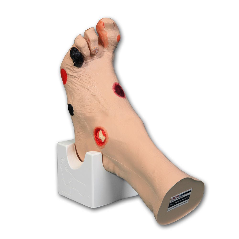 Wilma Wound Foot VTA0950 | Sim & Skills