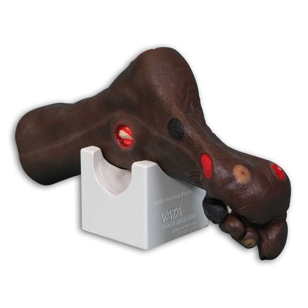 Wilma Wound Foot VTA0955 | Sim & Skills