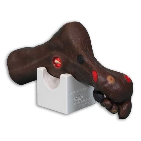 Wilma Wound Foot VTA0955 | Sim & Skills