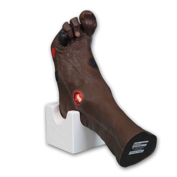 Wilma Wound Foot - Sim & Skills